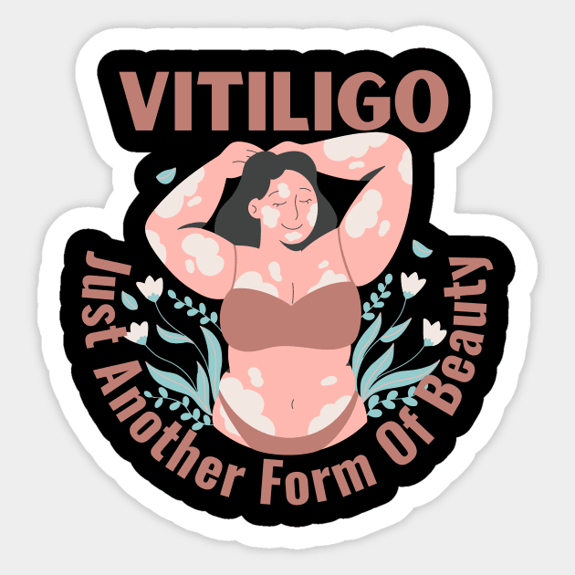 Vitiligo Just Another Form Of Beauty Female Model Sticker by Designs by Mim